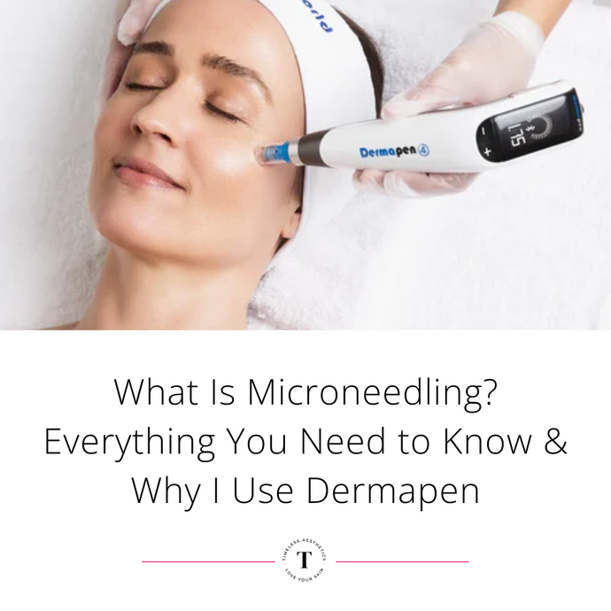 What Is Microneedling? Everything You Need to Know & Why I Use Dermapen