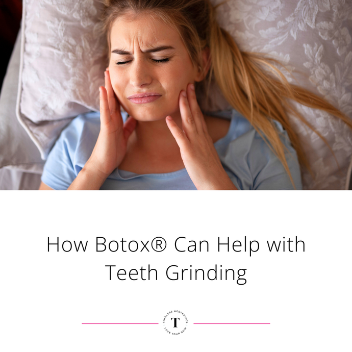 How Botulinum Toxin A Injections® Can Help with Teeth Grinding