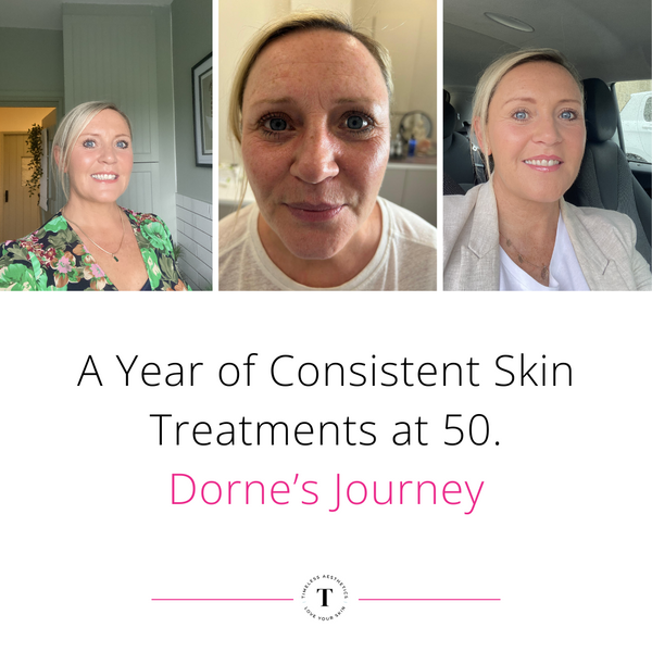 A Year of Consistent Skin Treatments at 50. Dorne’s Journey