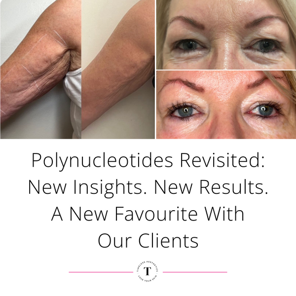 Polynucleotides Revisited: New Insights. New Results. A New Favourite With Our Clients