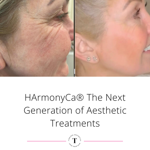 HAmonyCa® The Next Generation of Aesthetic Treatments