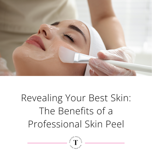 Revealing Your Best Skin: The Benefits of Medical Grade Skin Peels