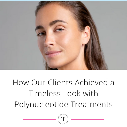 Real Stories: How Our Clients Achieved a Timeless Look with Polynucleotide Treatments