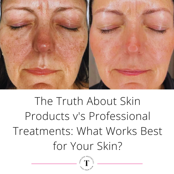 The Truth About Skin Products v's Professional Treatments: What Works Best for Your Skin?